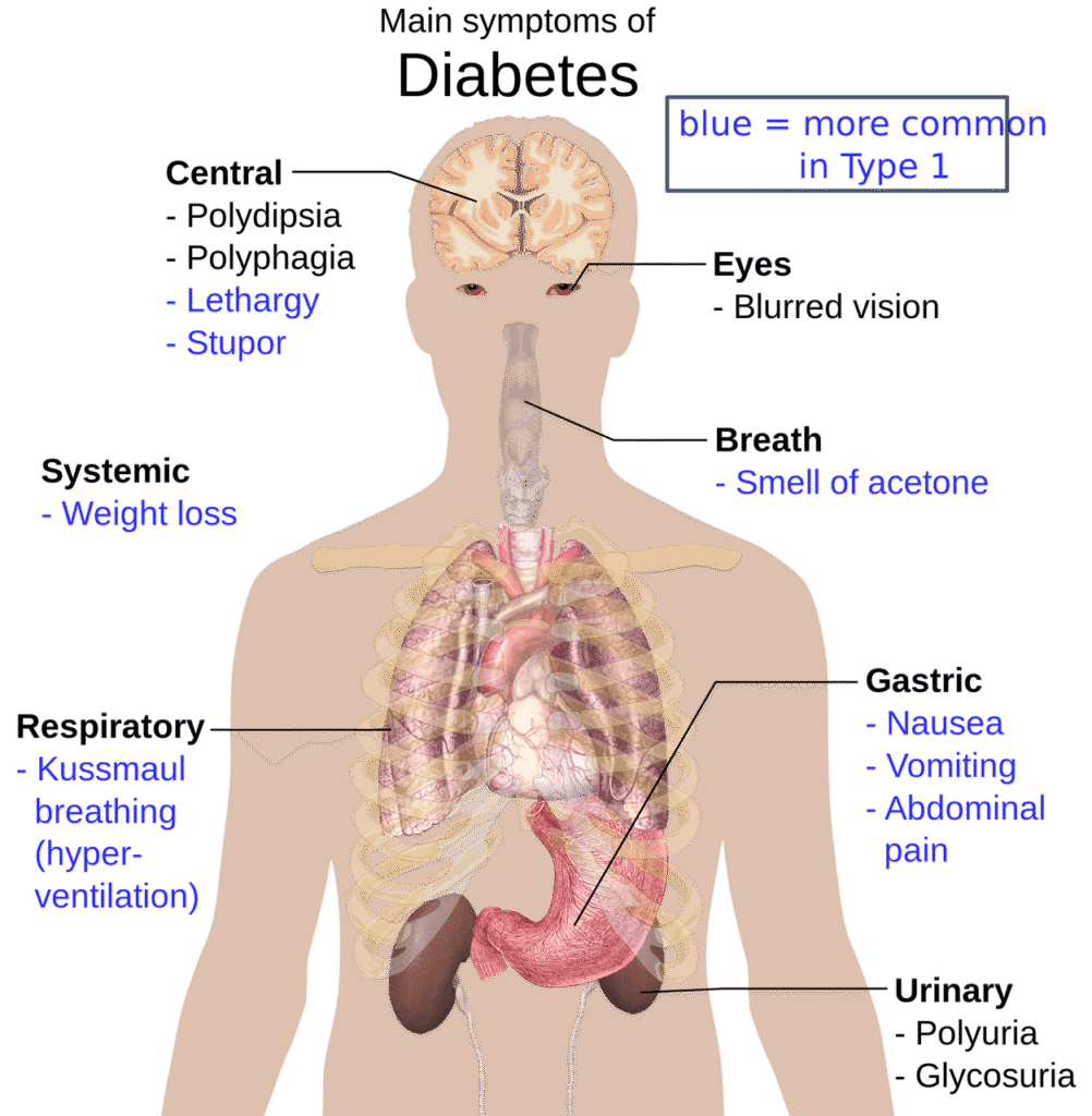 entdecken sie die häufigsten symptome von diabetes. erfahren sie, worauf sie achten sollten, um diabetes frühzeitig zu erkennen und rechtzeitig zu handeln.